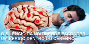 Apneia do sono pode provocar micro-hemorragias cerebrais